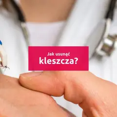 Pinceta delikatnie usuwa kleszcza ze skóry. Dowiedz się, jak wyciągnąć kleszcza bezpiecznie i skutecznie.