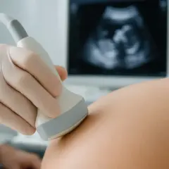 USG jamy brzusznej, widok płodu na ekranie. To może być 6 tydzień ciąży, początek nowego życia.