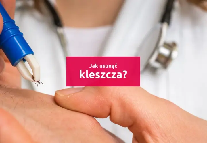 Pinceta delikatnie usuwa kleszcza ze skóry. Dowiedz się, jak wyciągnąć kleszcza bezpiecznie i skutecznie.