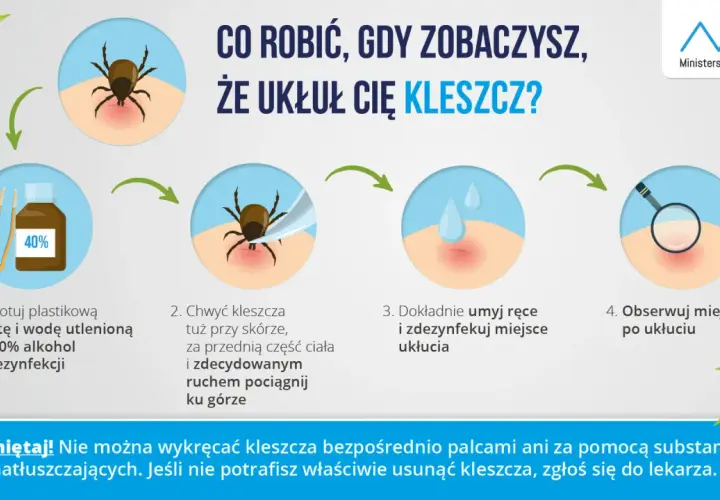 Instrukcja usuwania kleszcza: przygotuj pęsetę i środek dezynfekujący, chwyć kleszcza blisko skóry i wyciągnij go ruchem jednostajnym. Umyj i zdezynfekuj miejsce ukłucia. Obserwuj je po usunięciu.