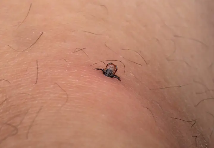 Mały, ciemny kleszcz wbity w skórę, z widocznymi odnóżami. Tak wygląda kleszcz po 24 godzinach, zaczyna się nasycać.