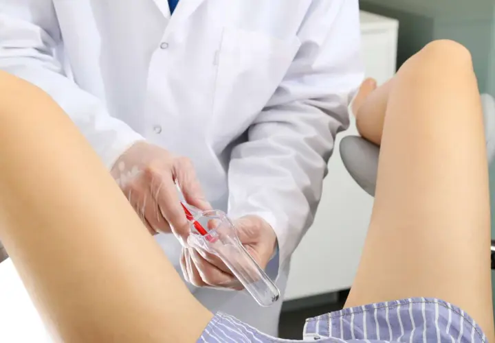 Lekarz w białym fartuchu i rękawiczkach przygotowuje się do badania ginekologicznego, trzymając wziernik.