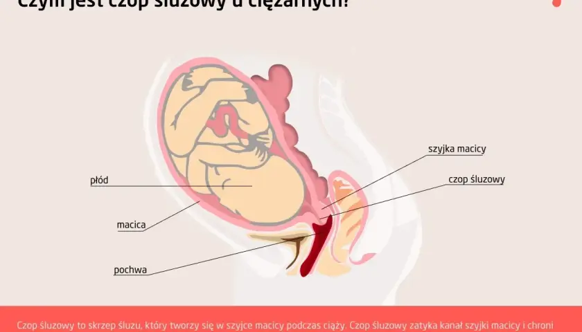 Ilustracja przedstawia przekrój przez ciążową macicę z płodem. Widoczny jest czop śluzowy zamykający szyjkę macicy, chroniący płód.