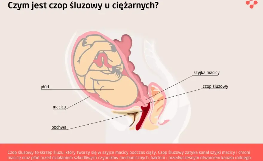 Śluz w ciąży - kiedy to norma, a kiedy infekcja lub czop śluzowy?