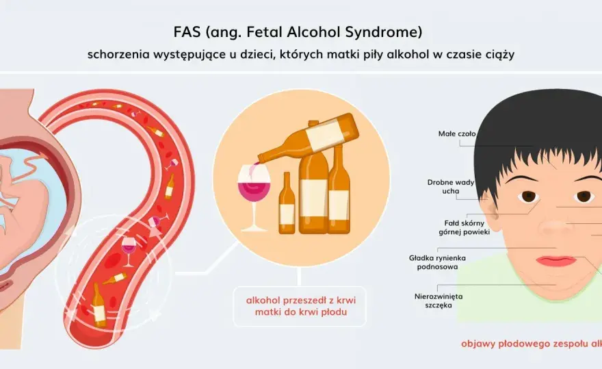 FAS - objawy, diagnoza i wsparcie po alkoholu w ciąży