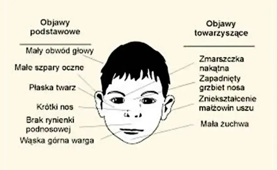 FAS u dziecka - jak rozpoznać i wspierać na co dzień