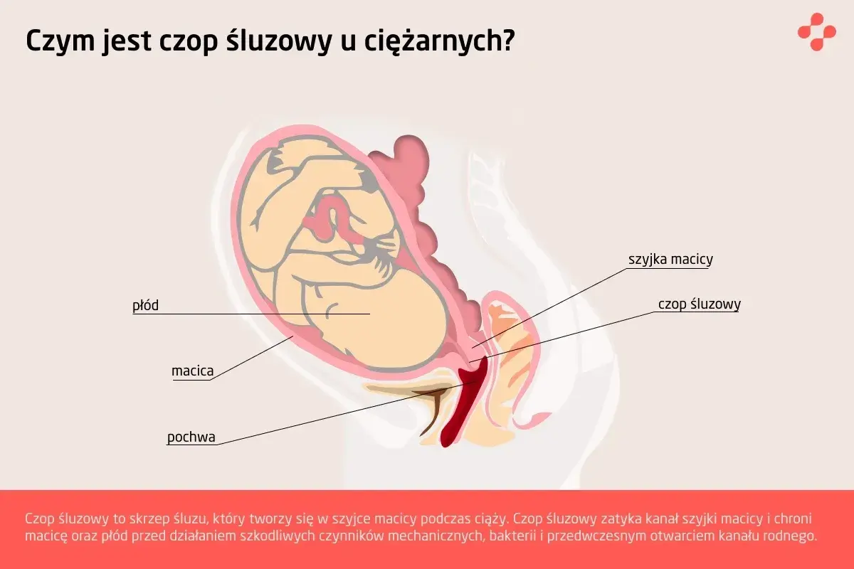 Ilustracja przedstawia przekrój przez ciążową macicę z płodem. Widoczny jest czop śluzowy zamykający szyjkę macicy, chroniący płód.