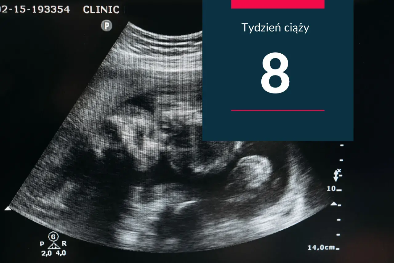 USG pokazuje zarodek w 8 tygodniu ciąży. Małe serduszko bije już mocno.
