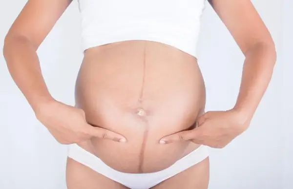 Brzuch kobiety w ciąży z widoczną ciemną linią, linea negra, podkreśloną palcami.